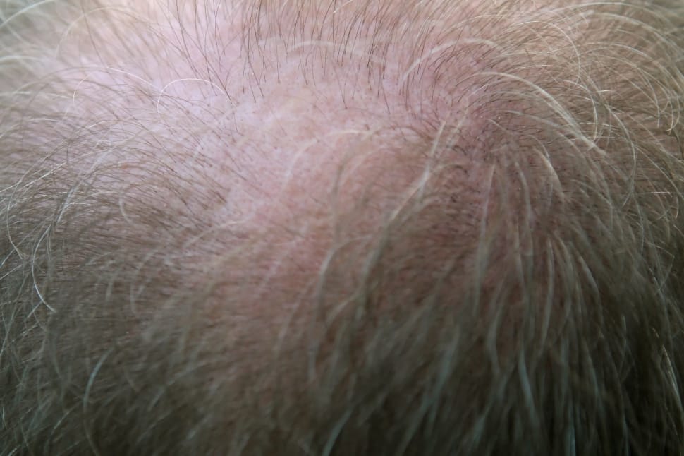 human scalp preview